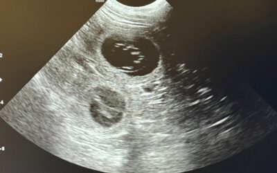 Robyn is expecting puppies by Olof in August!!